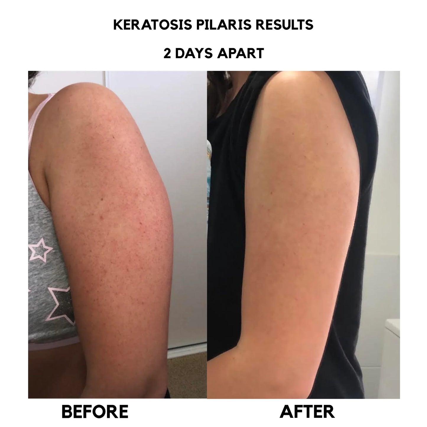 MyKPFix Advanced Skin Resurfacing + Hydrating Cream Formula