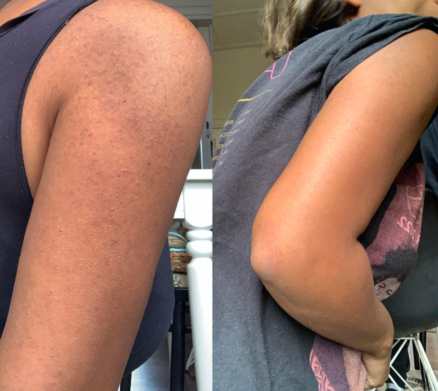 MyKPFix Advanced Skin Resurfacing + Hydrating Cream Formula