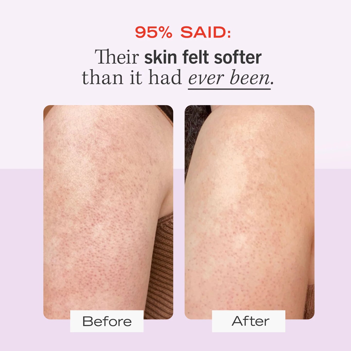 MyKPFix Advanced Skin Resurfacing + Hydrating Cream Formula